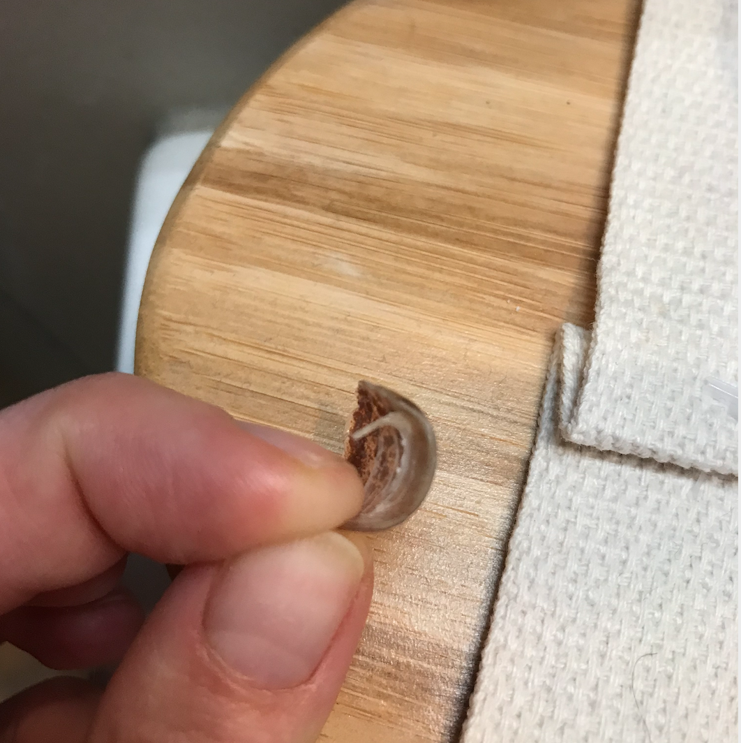 My Shellac Came Off And Caused An Ingrown Toenail?