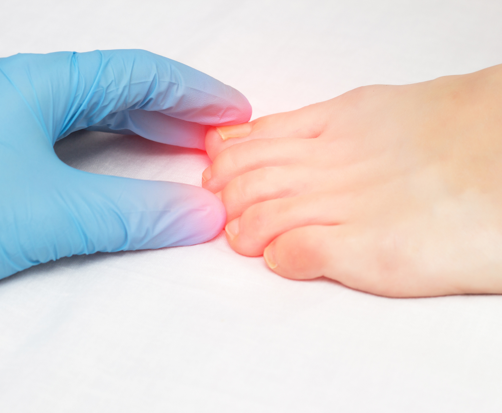 Debunking Your Top Ingrown Toenail Myths